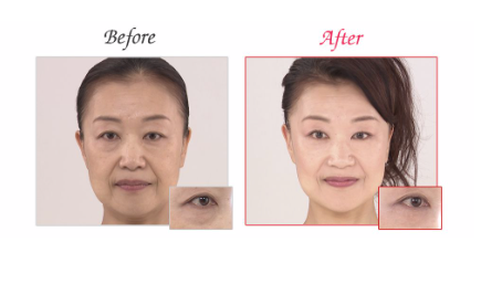 Meishoku Pintup Eye Serum 18g