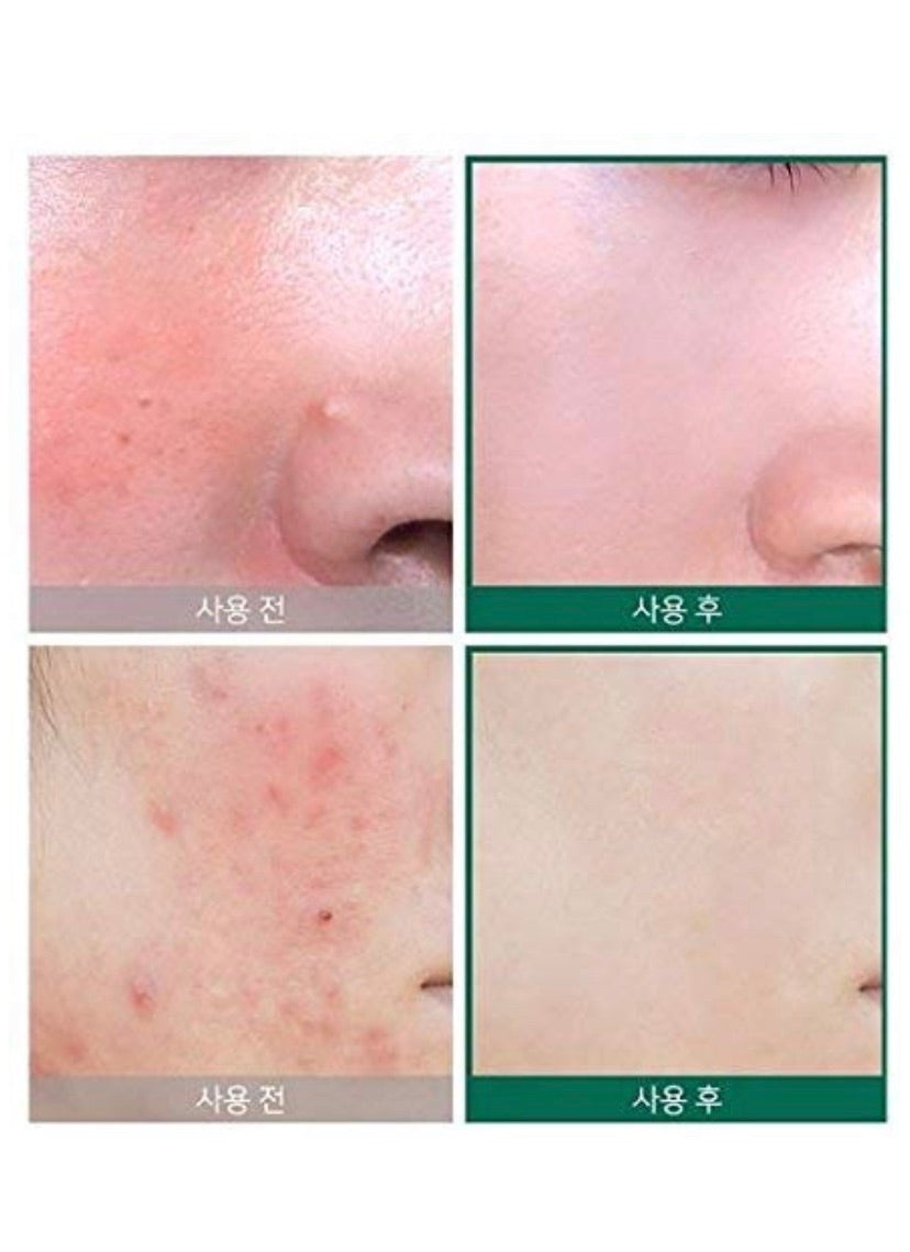 Somebymi some by mi AHA BHA PHA 30Days Miracle Serum 50ml